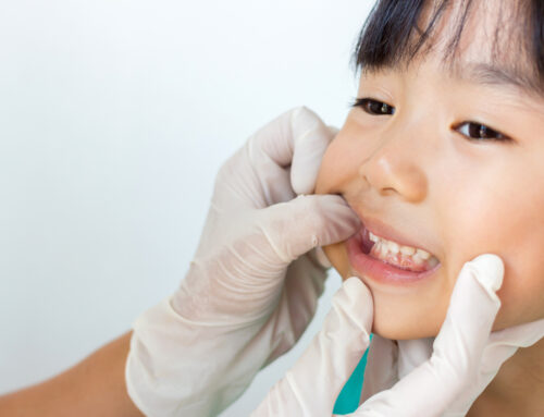 Q&A: Top Ways to Keep Children’s Teeth Healthy