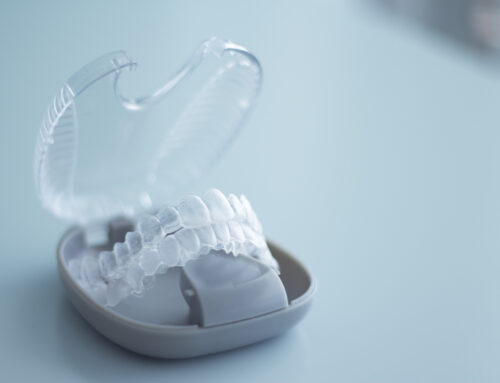 Don’t Lose Your Retainer! Tips from Orthodontists AND Parents