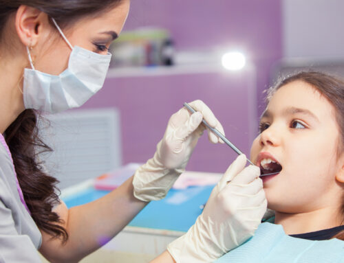 How Long Does a Dental Sealant Last?