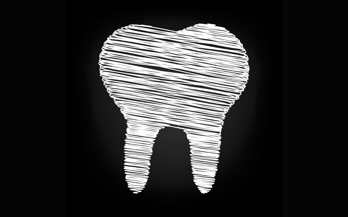 The Causes of “Chalky” Looking Teeth. Is it Preventable?