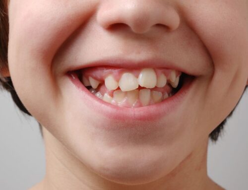 Do Teeth Straighten Out as They Grow?